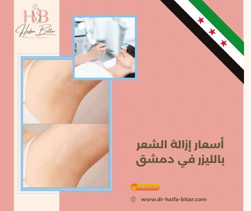 أسعار إزالة الشعر بالليزر في دمشق أسعار إزالة الشعر بالليزر في دمشق