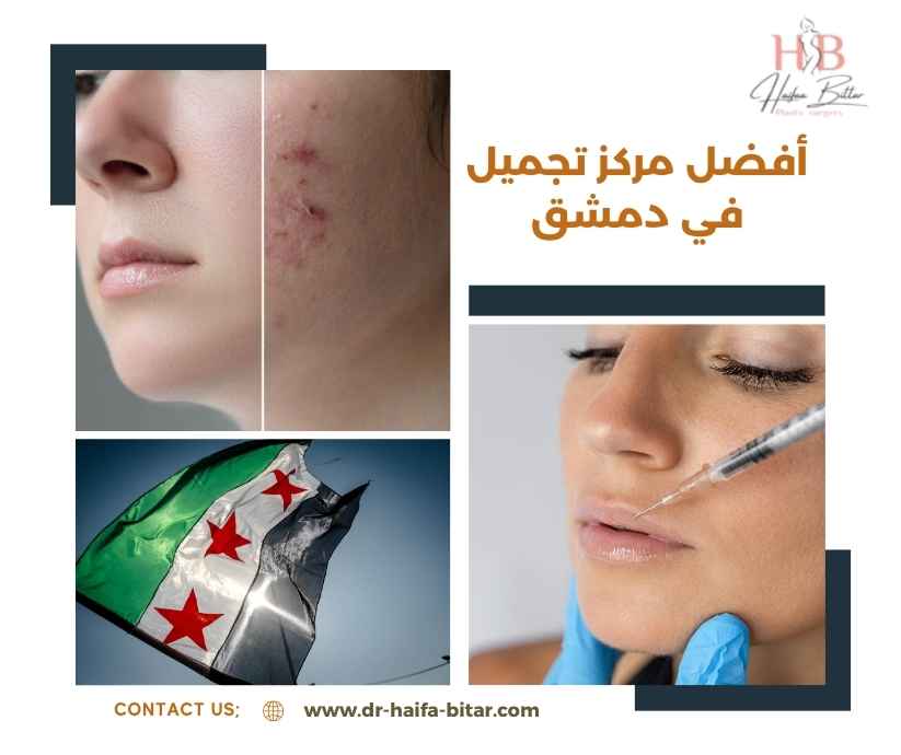 أفضل مركز تجميل في دمشق