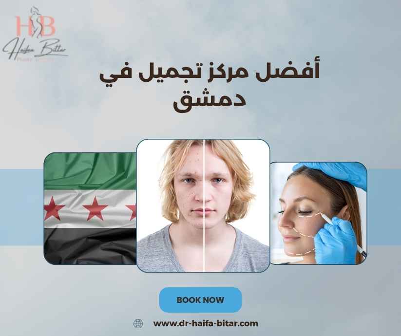 أفضل مركز تجميل في دمشق