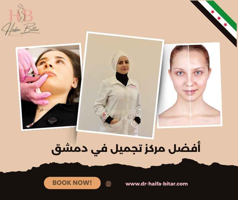 أفضل مركز تجميل في دمشق