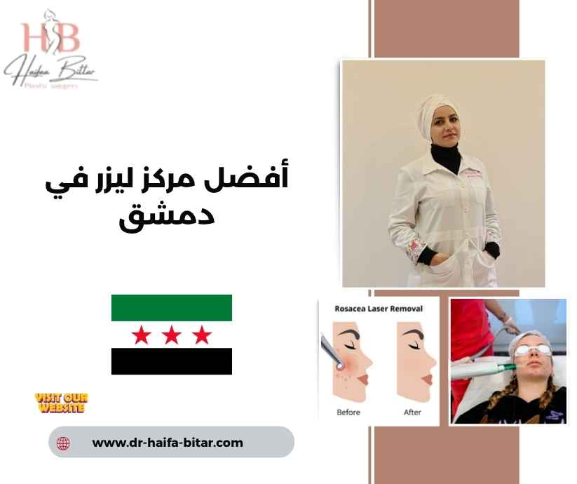 أفضل مركز ليزر في دمشق