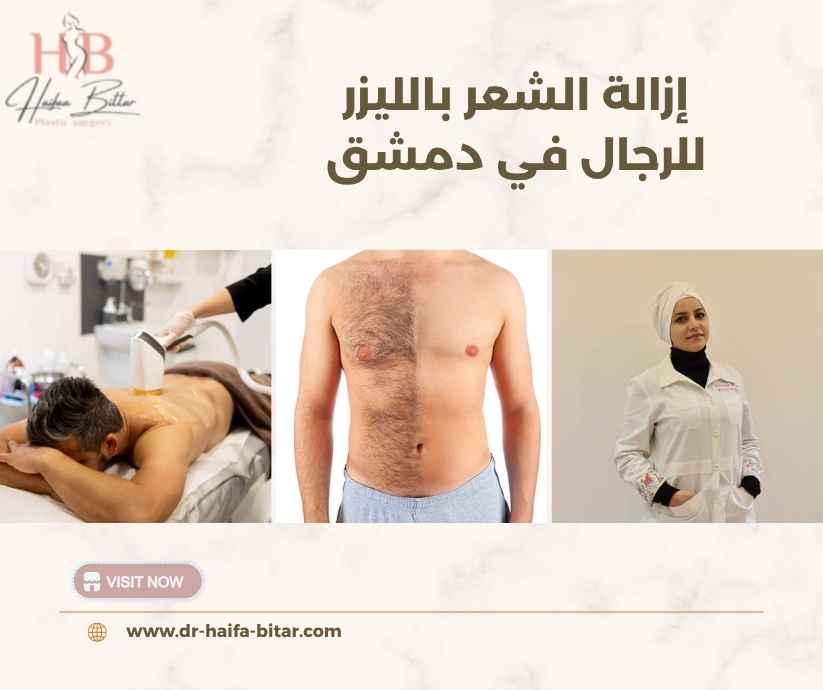 إزالة الشعر بالليزر للرجال في دمشق