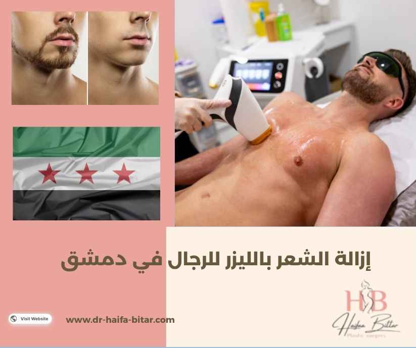 إزالة الشعر بالليزر للرجال في دمشق