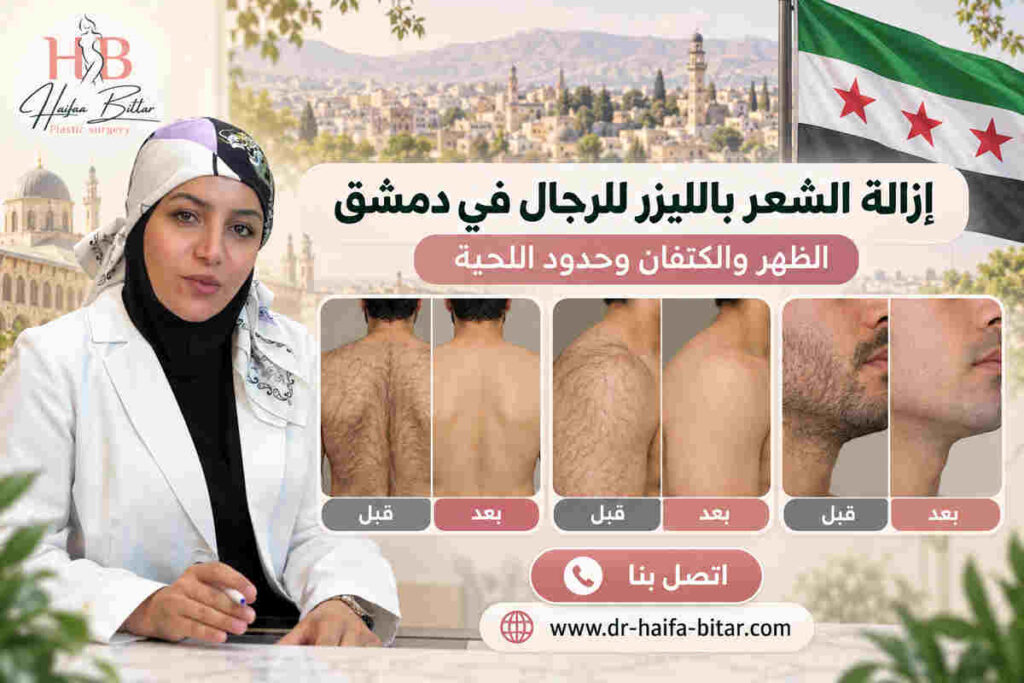 إزالة الشعر بالليزر للرجال في دمشق