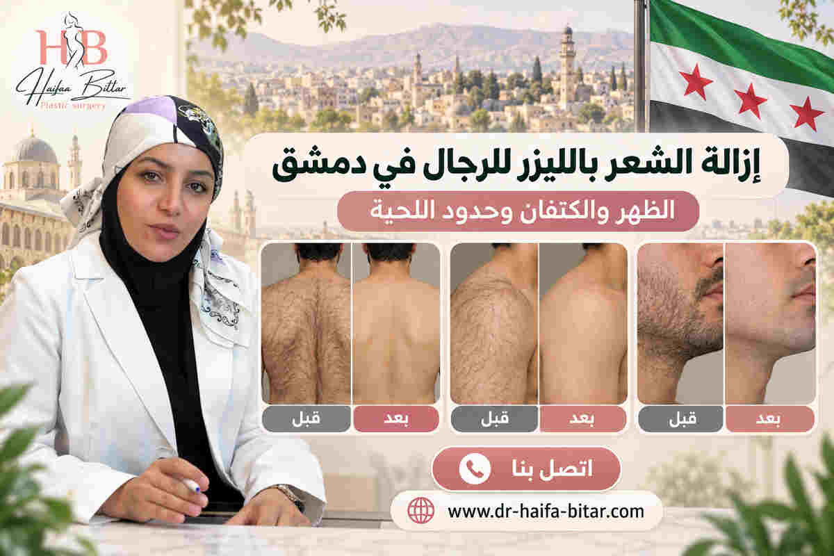 إزالة الشعر بالليزر للرجال في دمشق