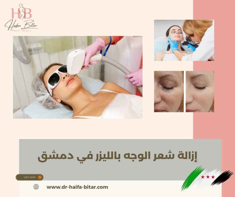 إزالة شعر الوجه بالليزر في دمشق