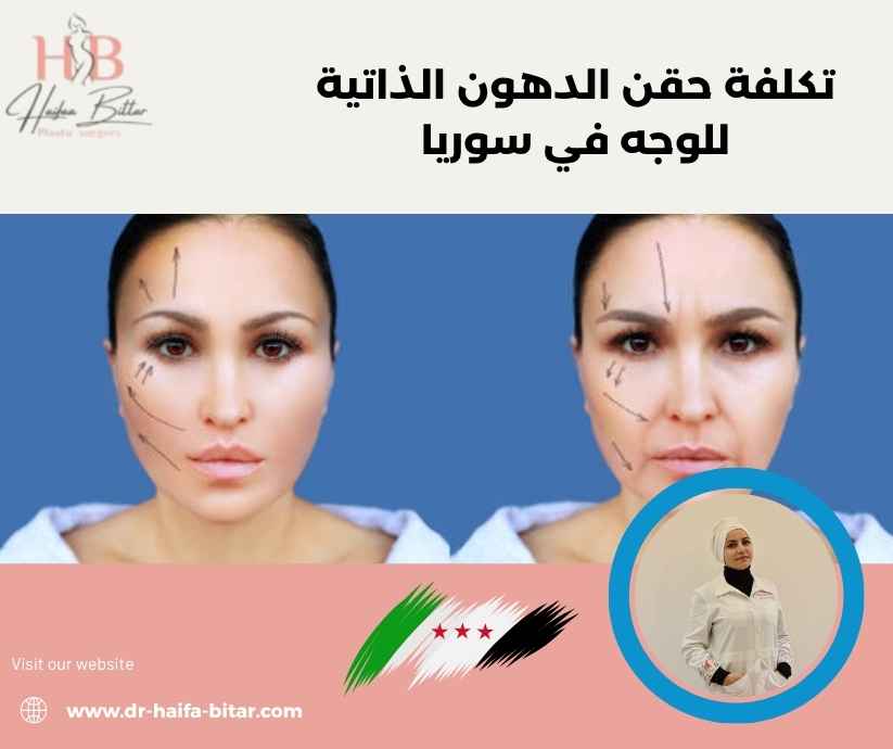 تكلفة حقن الدهون الذاتية للوجه في سوريا