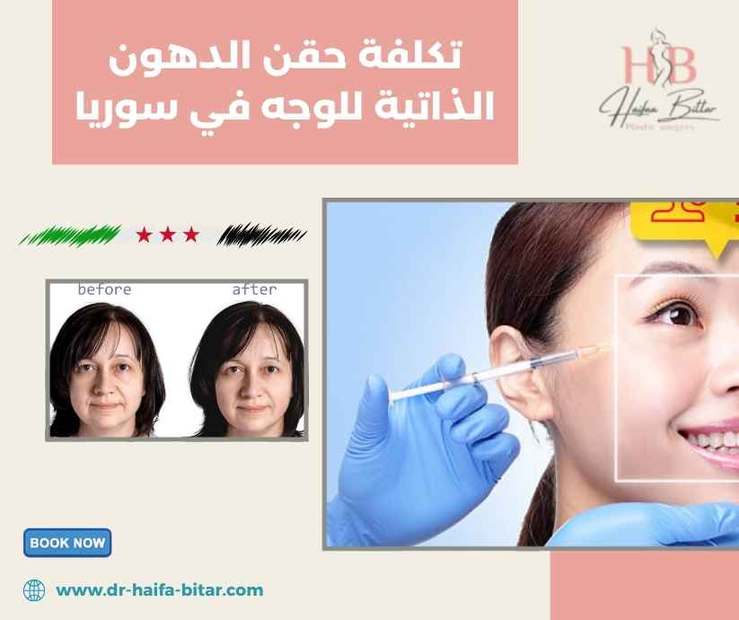 تكلفة حقن الدهون الذاتية للوجه في سوريا