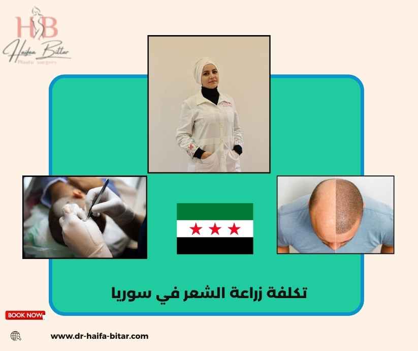 تكلفة زراعة الشعر في سوريا