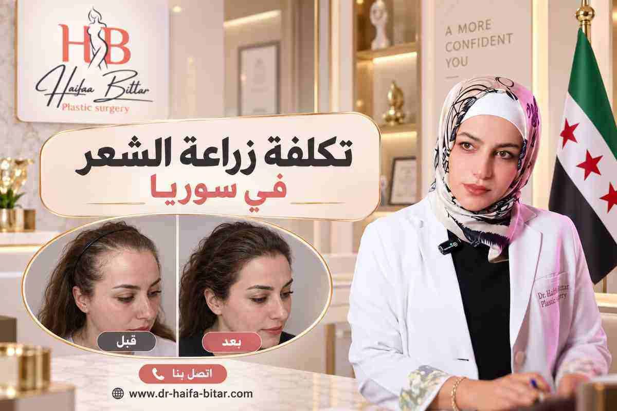 تكلفة زراعة الشعر في سوريا 