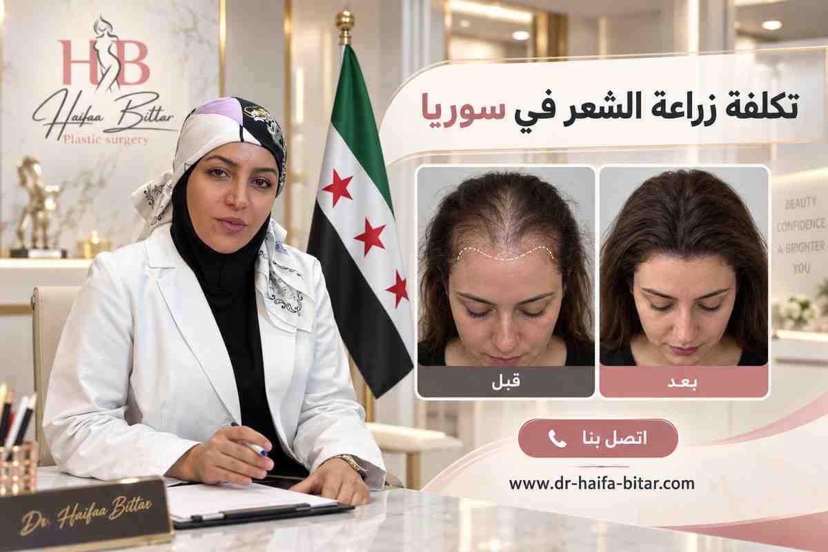 تكلفة زراعة الشعر في سوريا 
