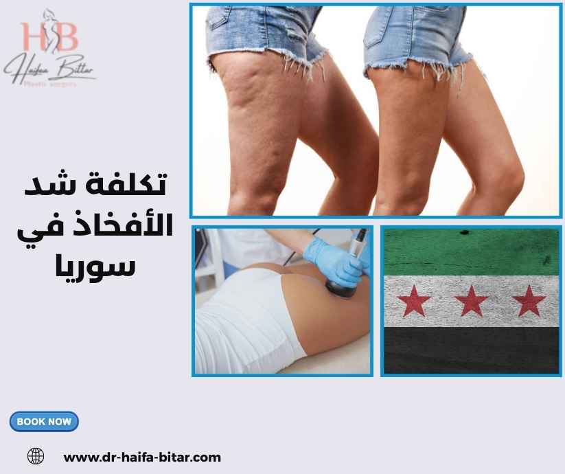 تكلفة شد الأفخاذ في سوريا