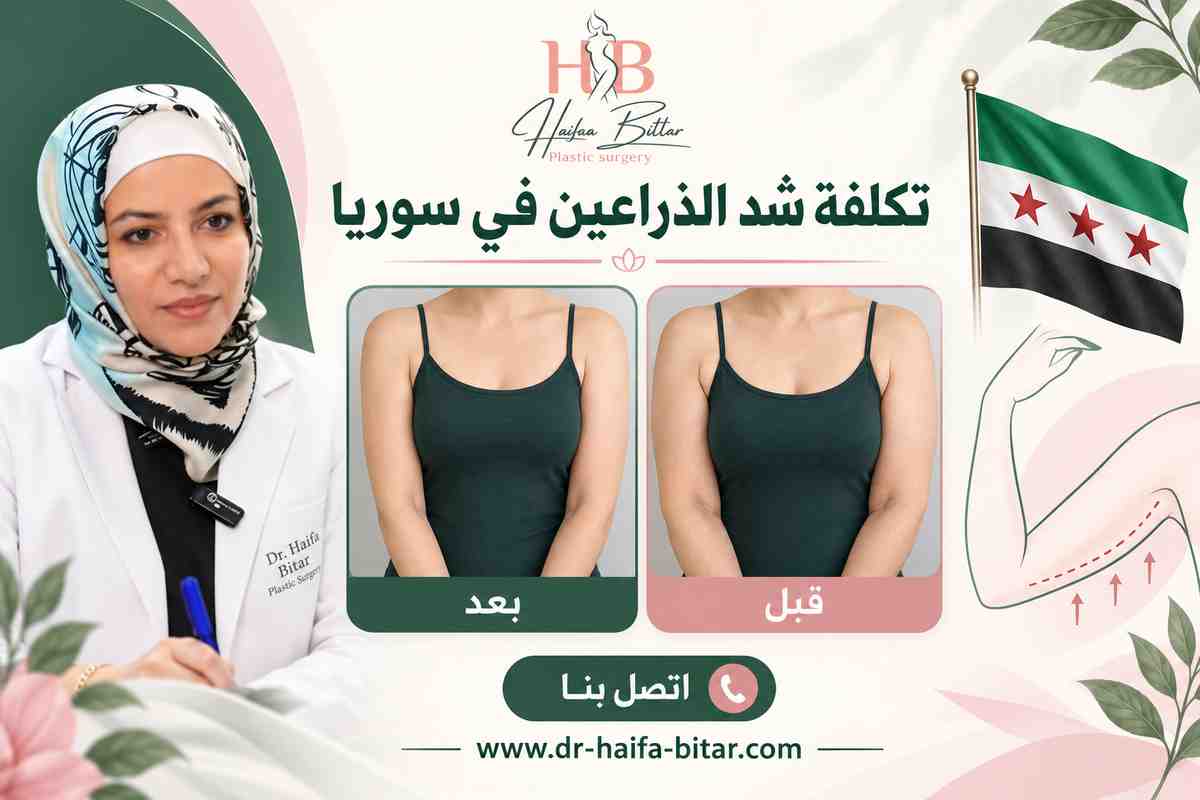 تكلفة شد الذراعين في سوريا تكلفة شد الذراعين في سوريا