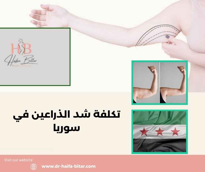 تكلفة شد الذراعين في سوريا تكلفة شد الذراعين في سوريا