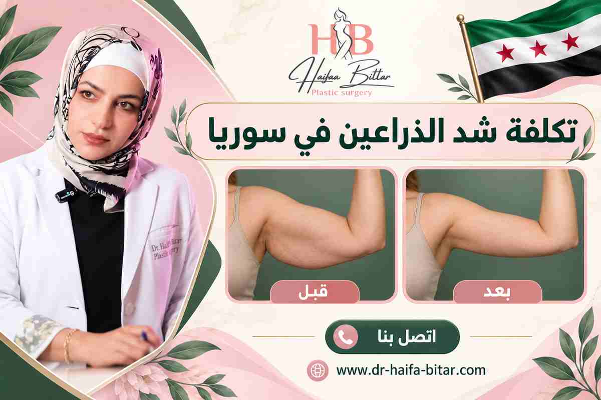 تكلفة شد الذراعين في سوريا تكلفة شد الذراعين في سوريا