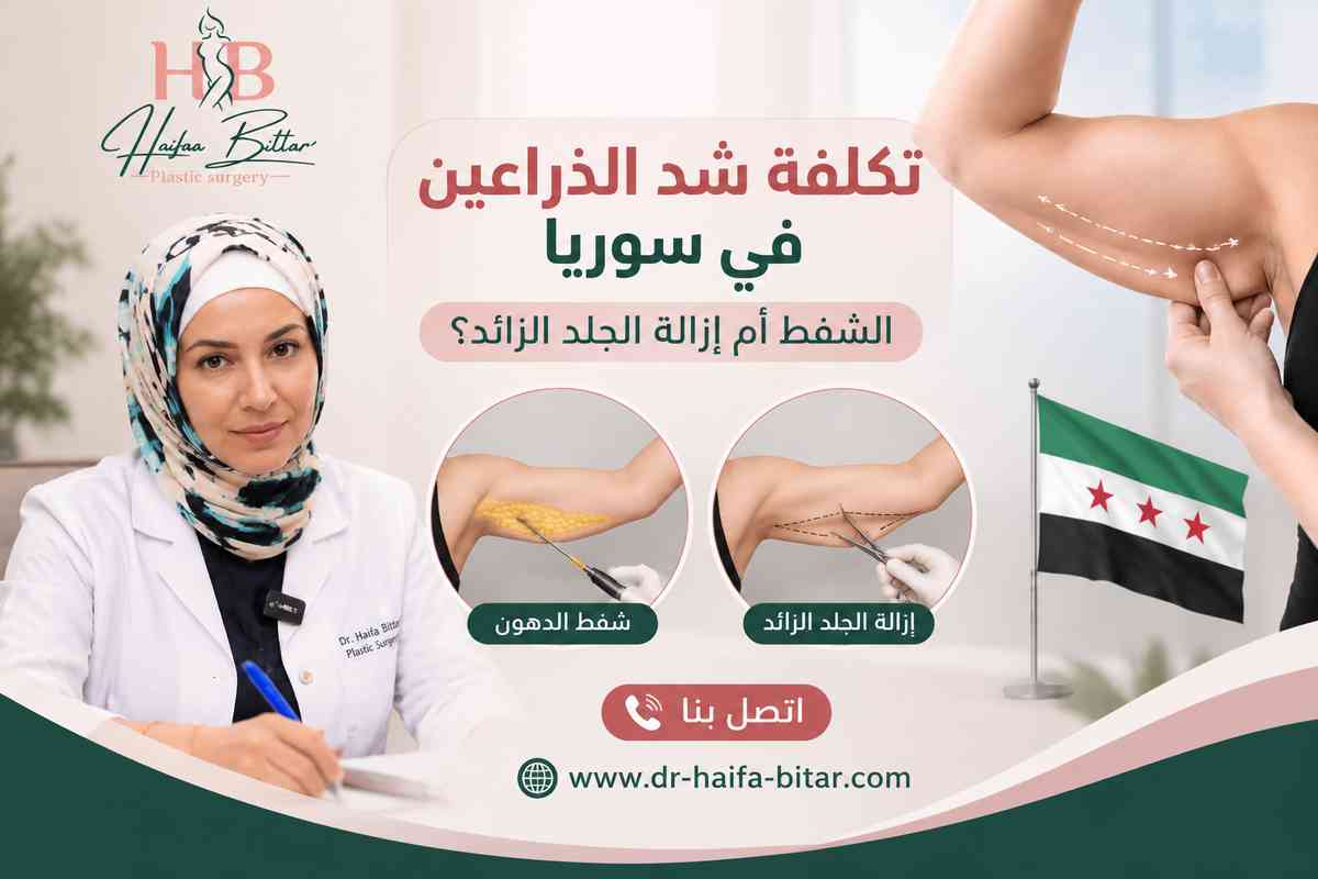 تكلفة شد الذراعين في سوريا