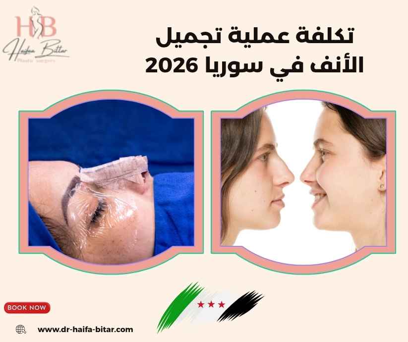 تكلفة عملية تجميل الأنف في سوريا 2026