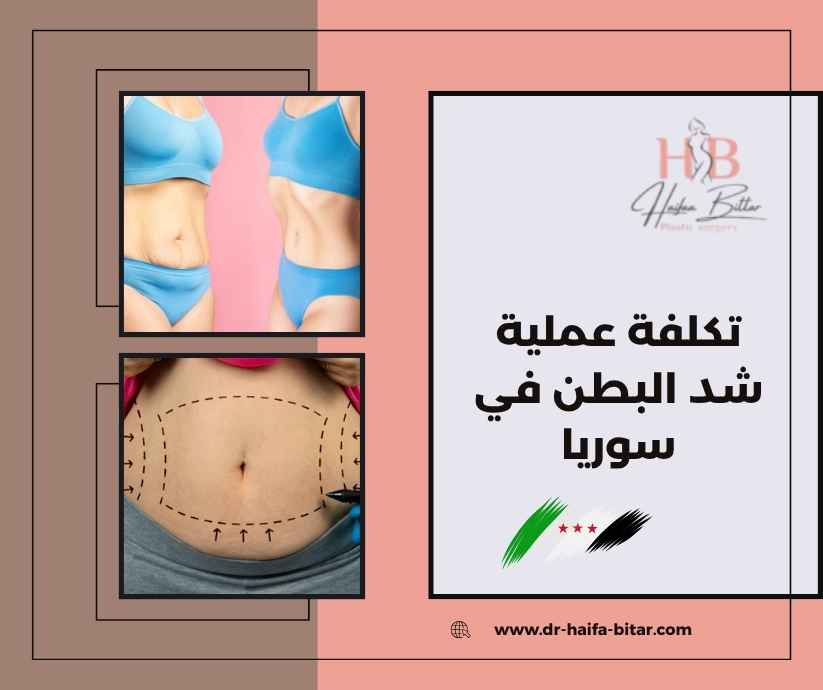 تكلفة عملية شد البطن في سوريا