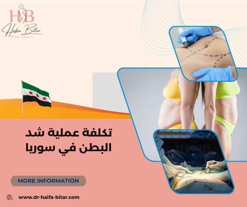 تكلفة عملية شد البطن في سوريا