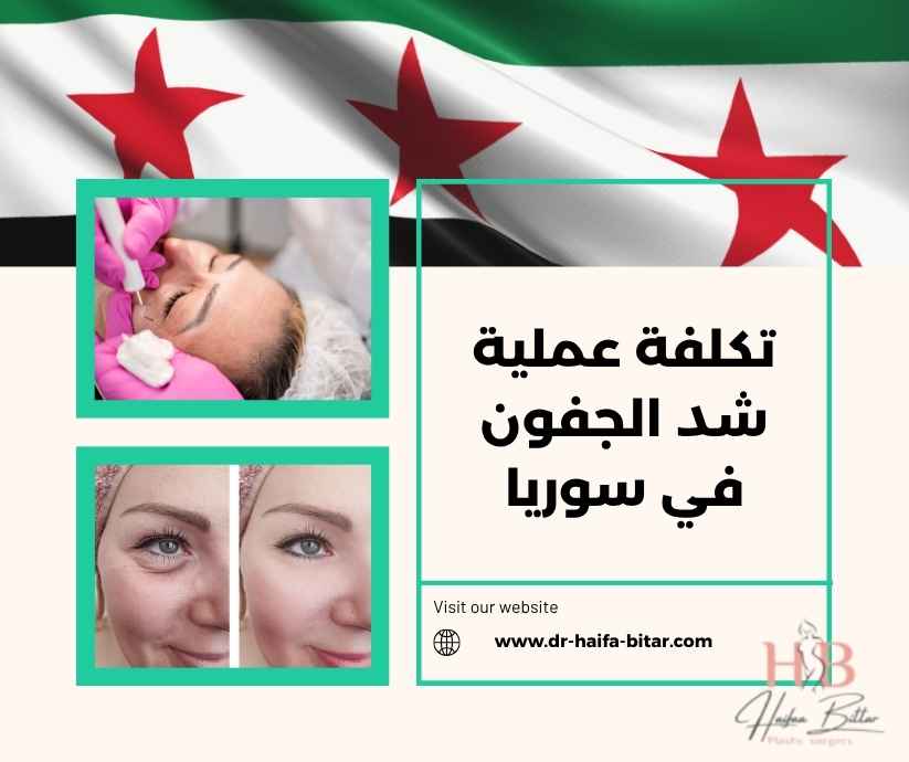 تكلفة عملية شد الجفون في سوريا