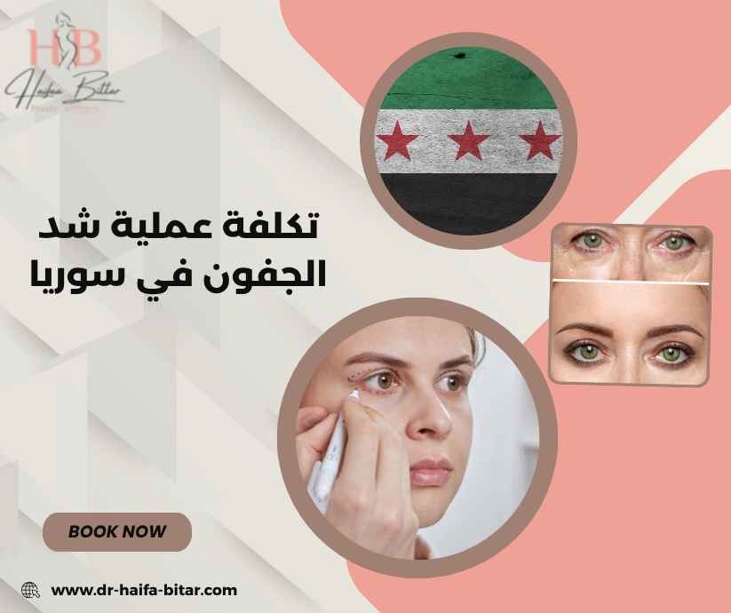 تكلفة عملية شد الجفون في سوريا