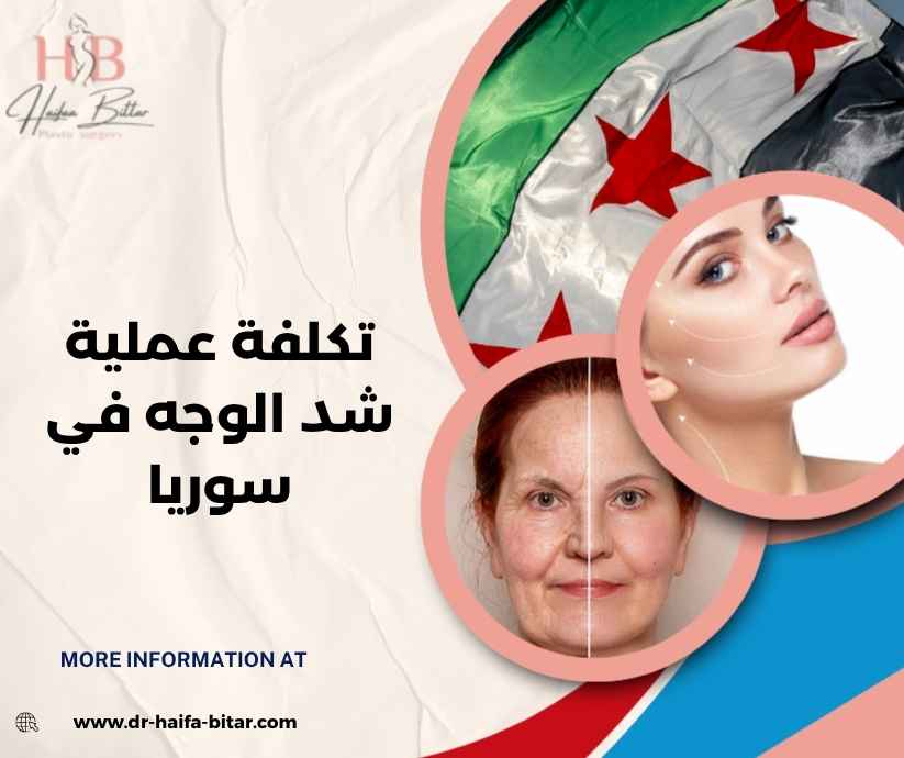 تكلفة عملية شد الوجه في سوريا