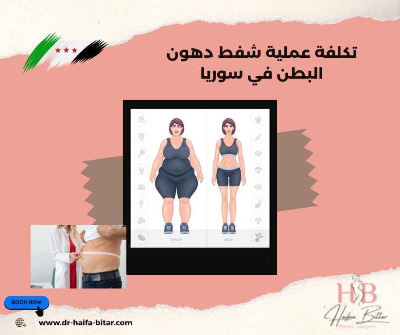 تكلفة عملية شفط دهون البطن في سوريا