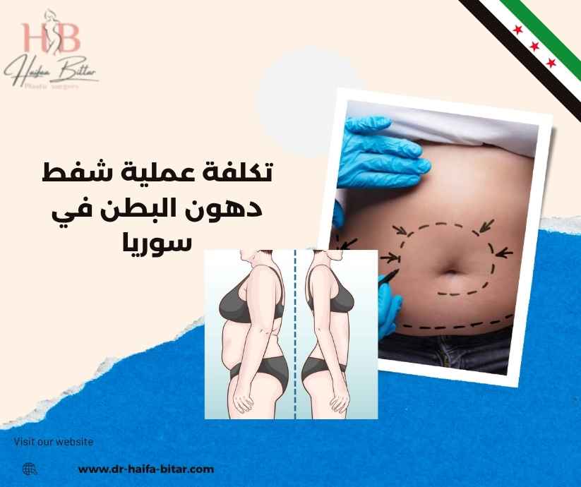 تكلفة عملية شفط دهون البطن في سوريا