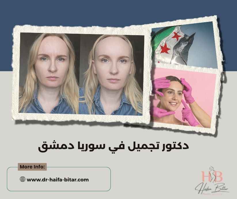 دكتور تجميل في سوريا دمشق