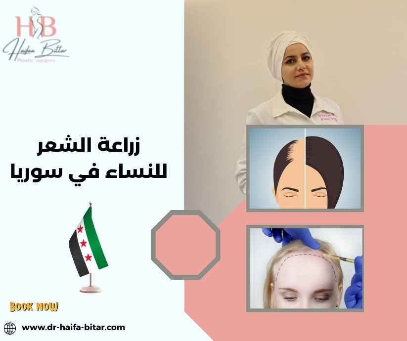 زراعة الشعر للنساء في سوريا