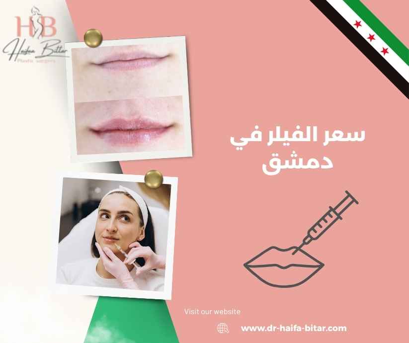 سعر الفيلر في دمشق