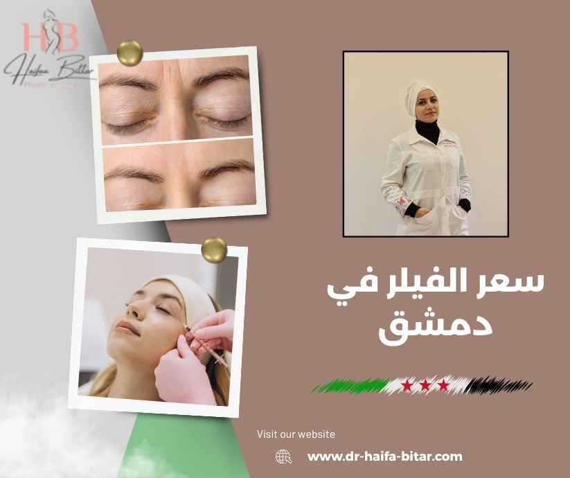 سعر الفيلر في دمشق