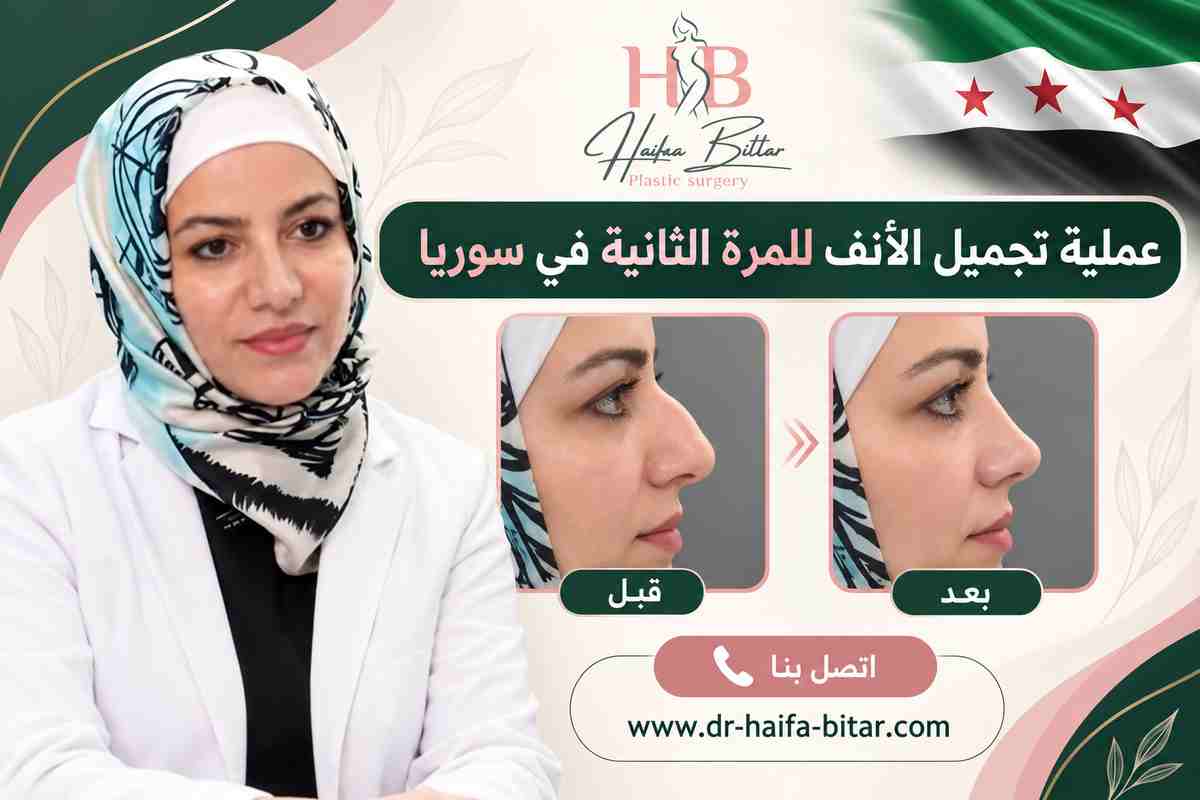 عملية تجميل الأنف للمرة الثانية في سوريا عملية تجميل الأنف للمرة الثانية في سوريا