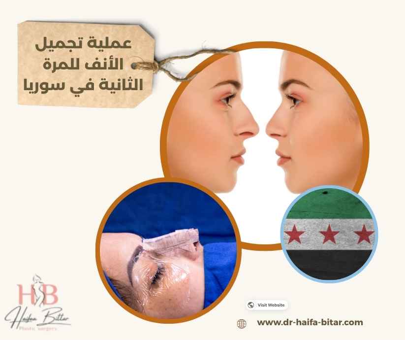 عملية تجميل الأنف للمرة الثانية في سوريا