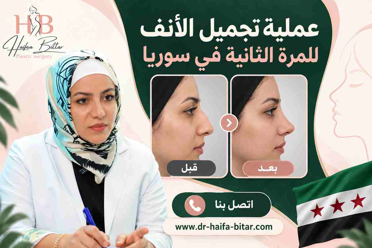 عملية تجميل الأنف للمرة الثانية في سوريا عملية تجميل الأنف للمرة الثانية في سوريا
