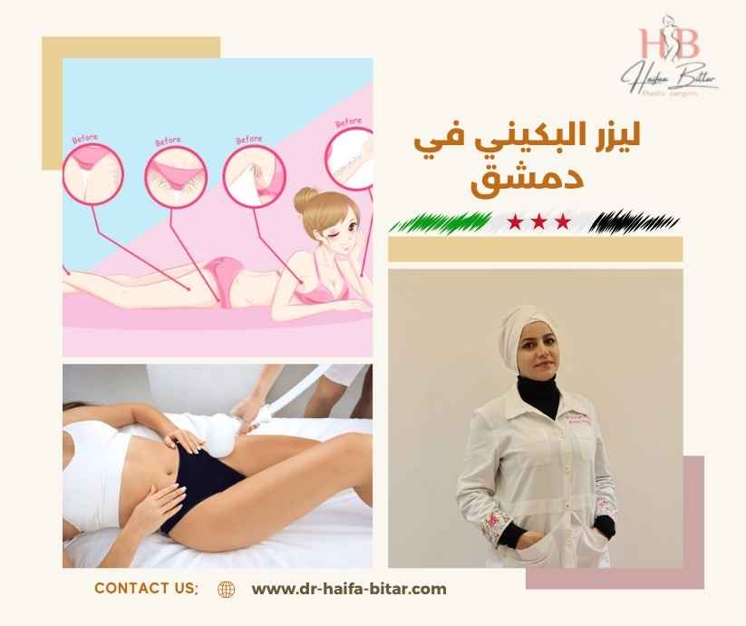 ليزر البكيني في دمشق ليزر البكيني في دمشق