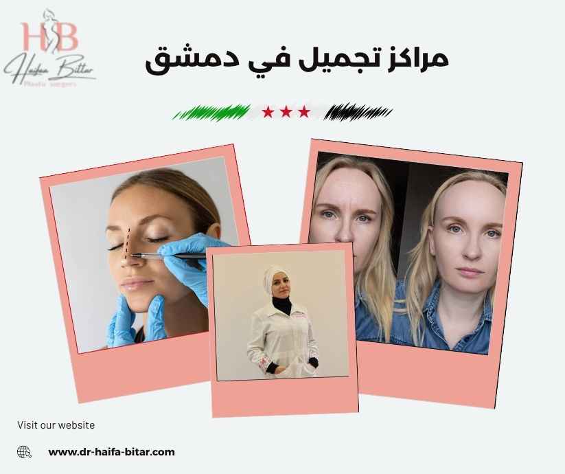 مراكز تجميل في دمشق مراكز تجميل في دمشق
