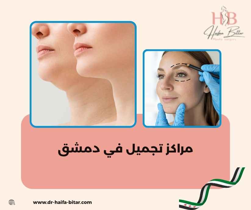 مراكز تجميل في دمشق مراكز تجميل في دمشق